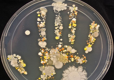 Figure 1: Handprint of unwashed hand showing growth of Transient & Resident flora